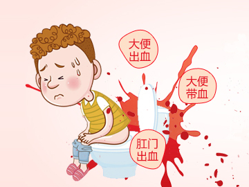 北京东大肛肠医院:你知道什么是便血吗?