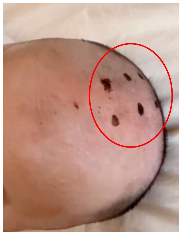 姐姐在弟弟头顶手绘6个"戒疤",弟弟瞬间变小和尚,妈妈无语了