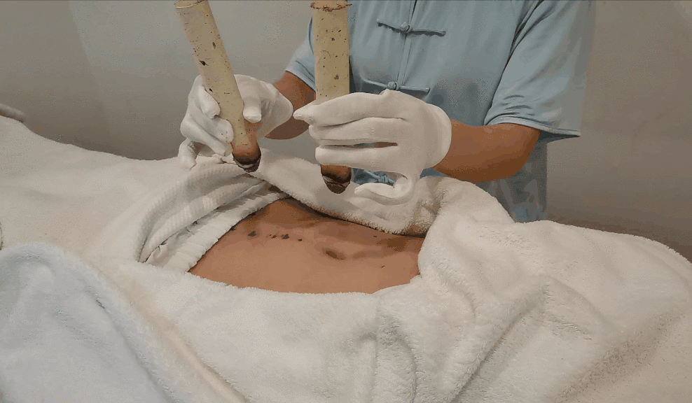 艾灸|穴位|关元_新浪新闻