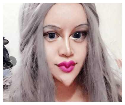 刘梓晨不再是"蛇精脸",再次整容五官变成超精致,网友直呼好帅