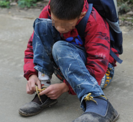 农村11岁小男孩,左脚比右脚大三倍,被人称为"大脚娃"