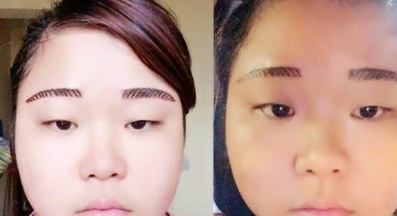 女子贪图便宜 花费300元做纹眉 结果眉毛变成了 斑马线 女子贪图便宜 花费300元做纹眉 结果眉毛变成了 斑马线