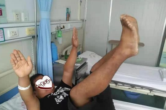 医生却说不足为奇|瘫痪|小伙|肢体_新浪新闻