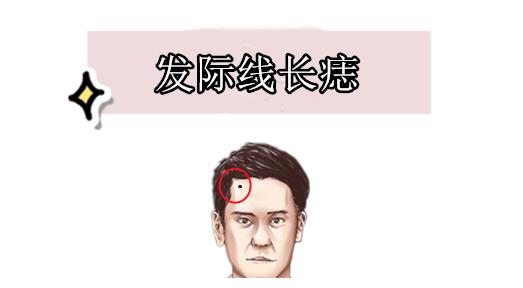 发际线长痣发际线的位置左右两边属于父母宫,代表的是父母之间的运势