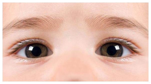 宝宝经常揉眼睛家长要引起重视可能是这四种情况