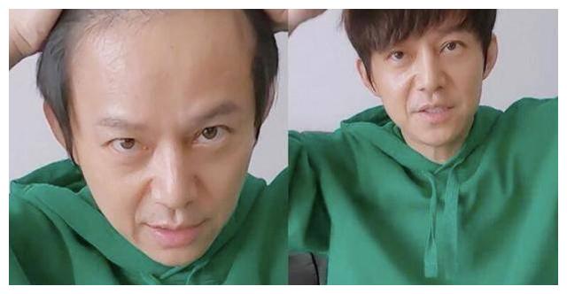 吴昕口无遮拦曝何炅植过发,何老师懵了!网友:挺秃然的