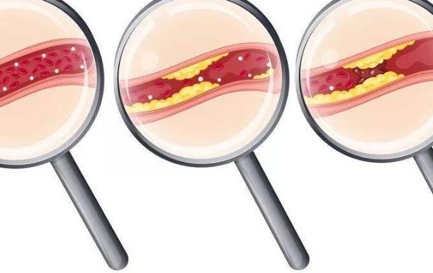 心脑血管疾病不是说来就来,5个习惯会增加患病风险,请尽快改正休闲区蓝鸢梦想 - Www.slyday.coM 心脑血管疾病不是说来就来,5个习惯会增加患病风险,请尽快改正休闲区蓝鸢梦想 - Www.slyday.coM