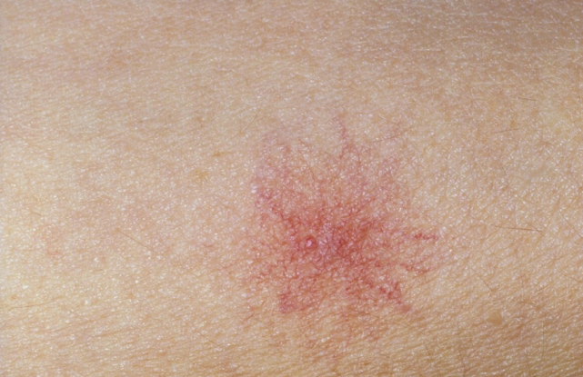 28岁全职妈妈“内卷”6年，确诊肝癌离世，医生：内卷害人不浅休闲区蓝鸢梦想 - Www.slyday.coM