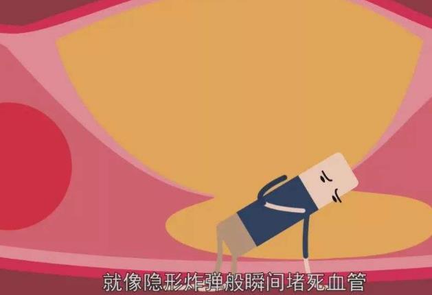 心脑血管疾病不是说来就来,5个习惯会增加患病风险,请尽快改正休闲区蓝鸢梦想 - Www.slyday.coM 心脑血管疾病不是说来就来,5个习惯会增加患病风险,请尽快改正休闲区蓝鸢梦想 - Www.slyday.coM