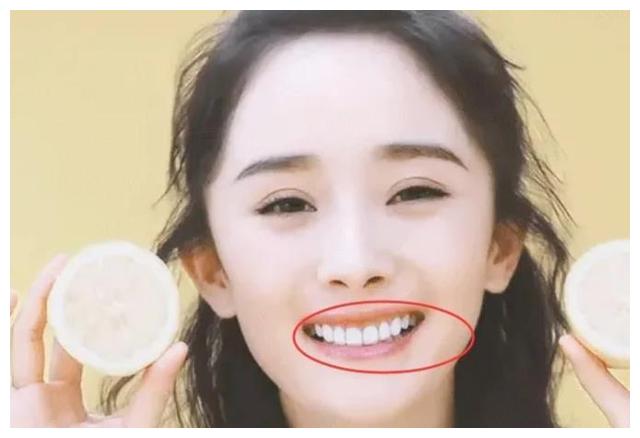 杨幂热巴烤瓷牙都翻车,赵丽颖宋茜天然牙很可爱,明星真不该动牙|牙齿