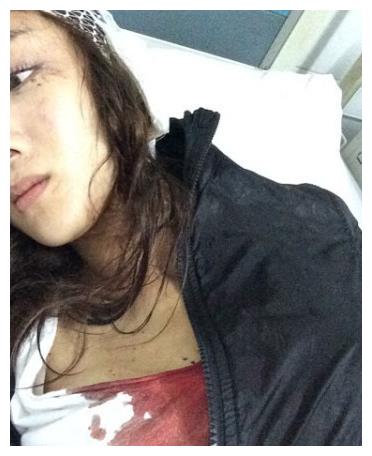 她曾是古装第一美人却被著名女星的狗咬毁容