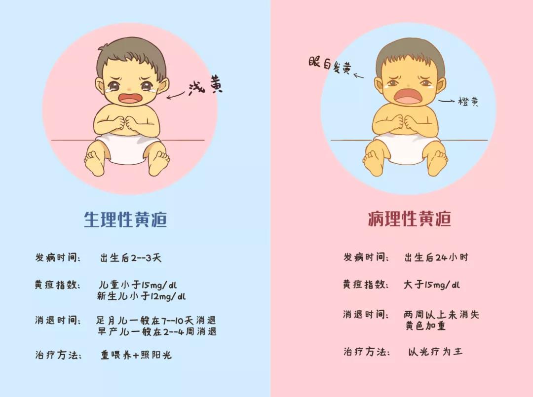新生儿黄疸值对照表1到30天 ( 高于17一定是病理性黄疸吗)