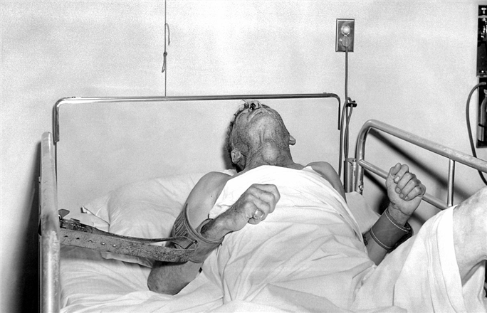 中年男子被狗咬伤,狂犬病发作离世,死前注射了疫苗,人还是没了休闲区蓝鸢梦想 - Www.slyday.coM 中年男子被狗咬伤,狂犬病发作离世,死前注射了疫苗,人还是没了休闲区蓝鸢梦想 - Www.slyday.coM