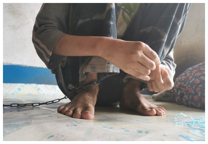 心疼!19岁男孩被铁链锁在家中数年,活着就需忍受命运的不公