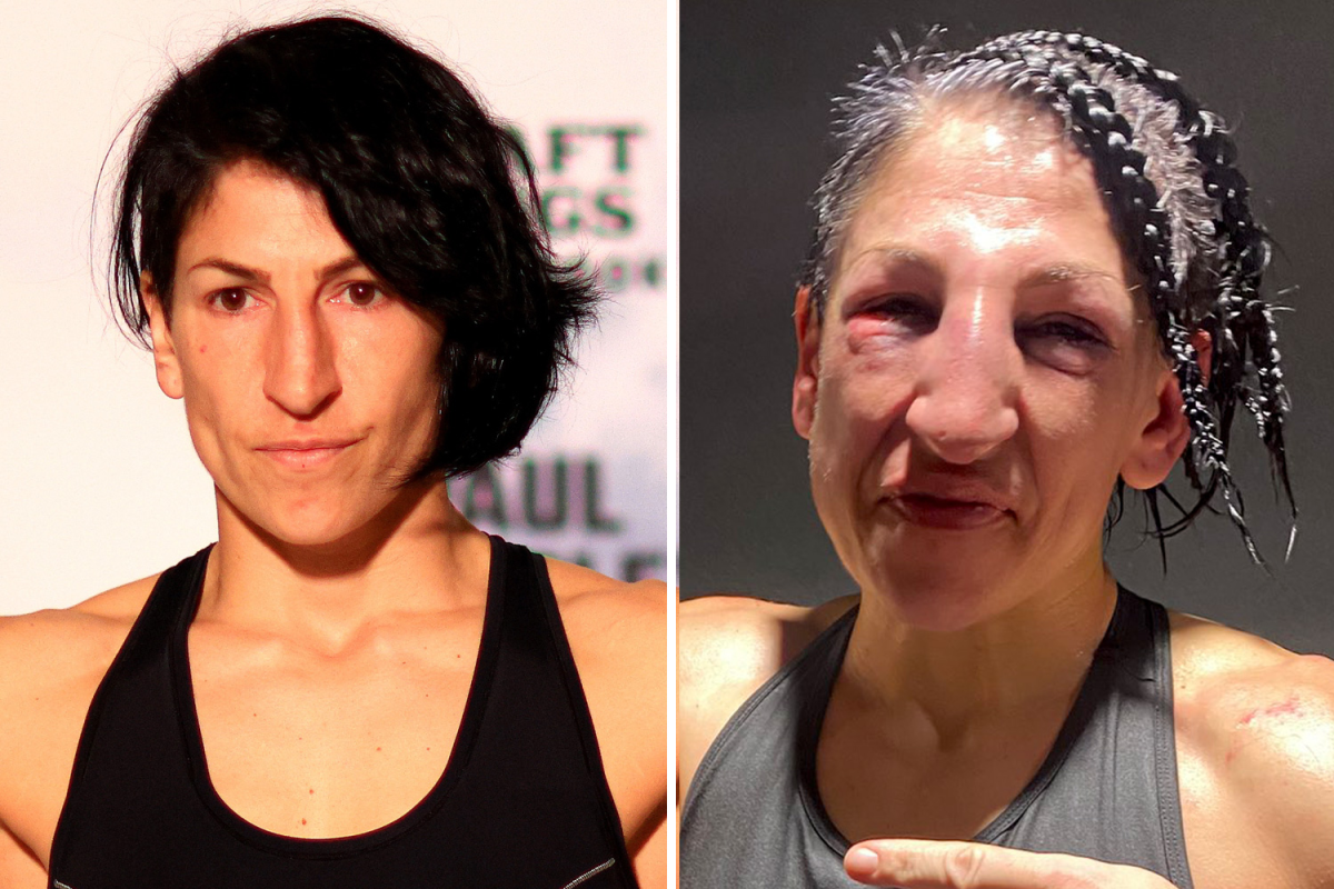 赛后脸肿到无限期停赛!|伍德利|古铁雷斯|无限期_新浪新闻