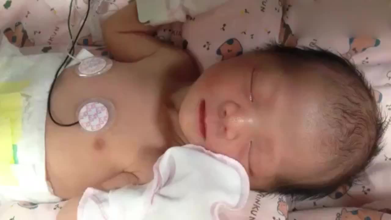 刚刚出生的35周早产儿宝宝 睡觉时受到一点干扰就会很快醒来
