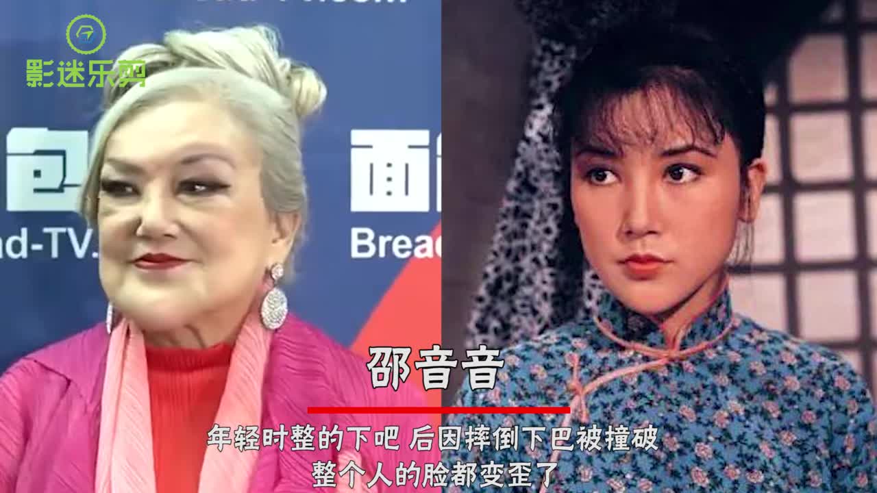 不幸毁容的明星,邵音音黄夏蕙曾吓跑小偷,胡歌阿娇令人感到惋惜