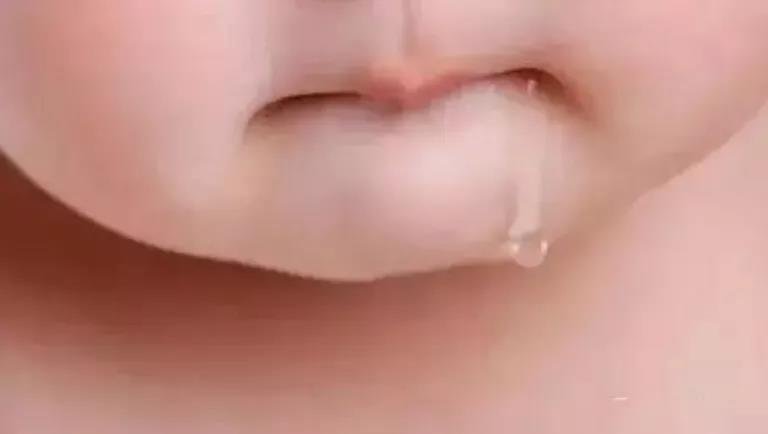 宝妈们注意啦,宝宝流口水,注意预防口水疹