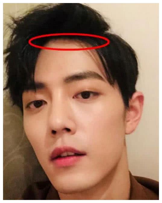 "古装男神"肖战,掀起刘海后,发际线太感人,粉丝哭晕在厕所