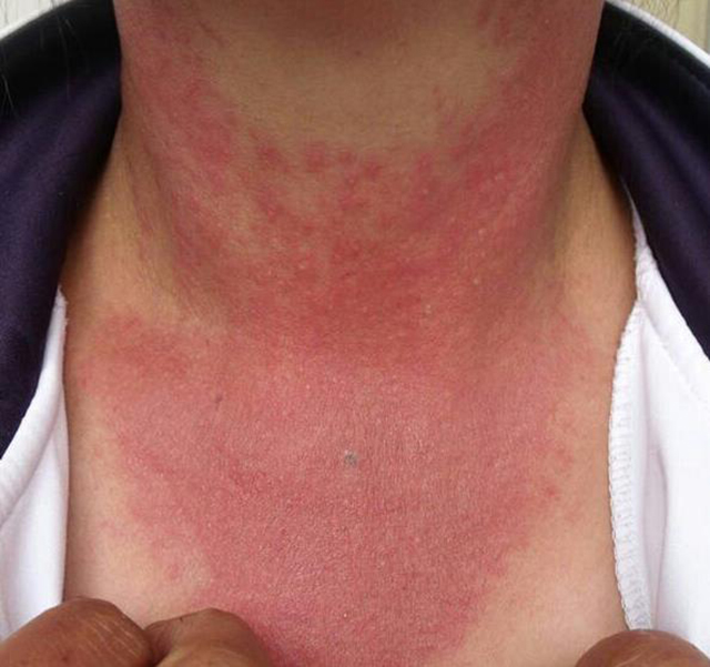 护肤多吃抗氧化食物日常可食用富含维c的水果,如番石榴,奇异果等,红色