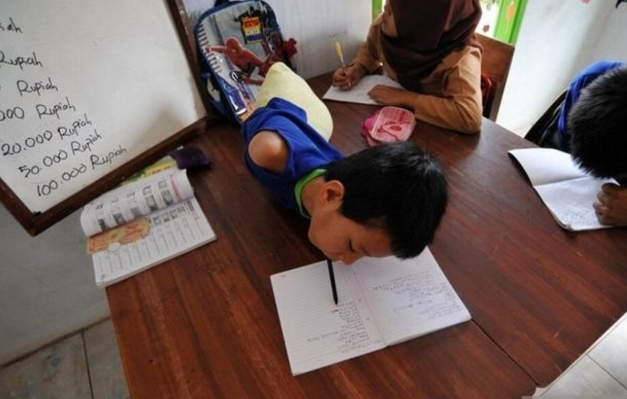 这个小男孩天生就没有四肢,但是他依然乐观的面对生活,令人佩服