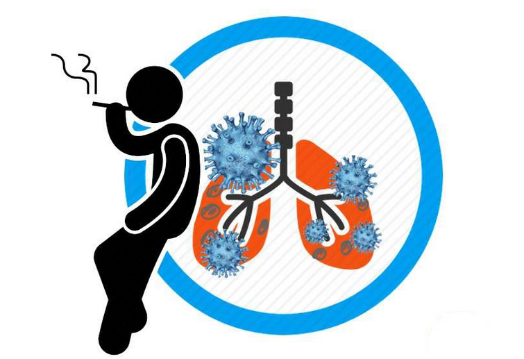 三姐妹不抽烟接连被查出肺癌!是传染?医生:这些因素要重视休闲区蓝鸢梦想 - Www.slyday.coM 三姐妹不抽烟接连被查出肺癌!是传染?医生:这些因素要重视休闲区蓝鸢梦想 - Www.slyday.coM