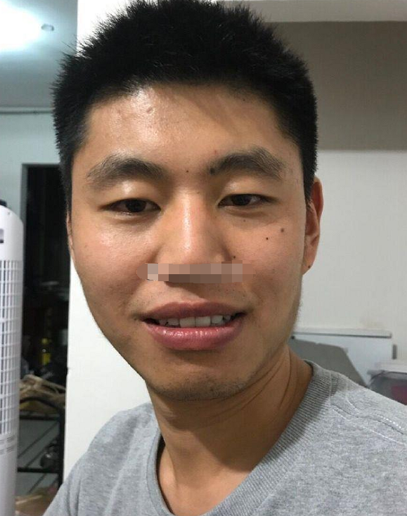 面相中眉头长痣中年人际关系不佳有事业失败的风险