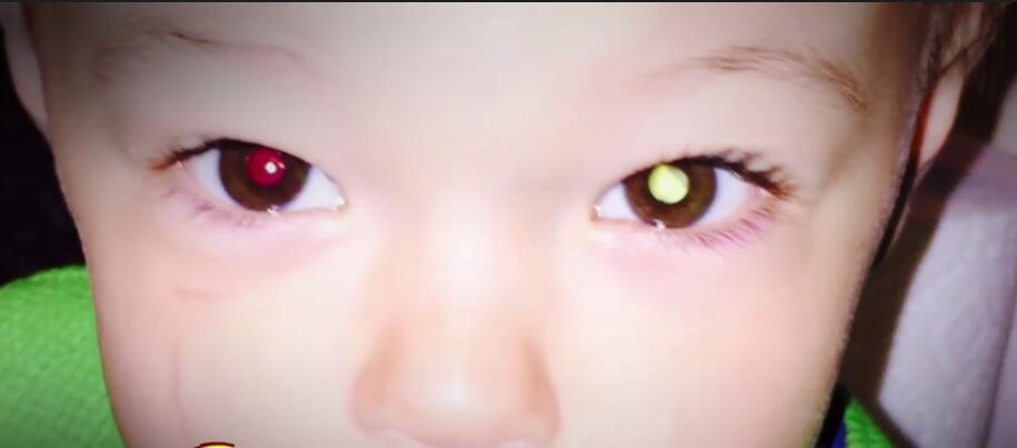 小孩从出生起就有有特异功能 两只瞳孔颜色不一却视力超常