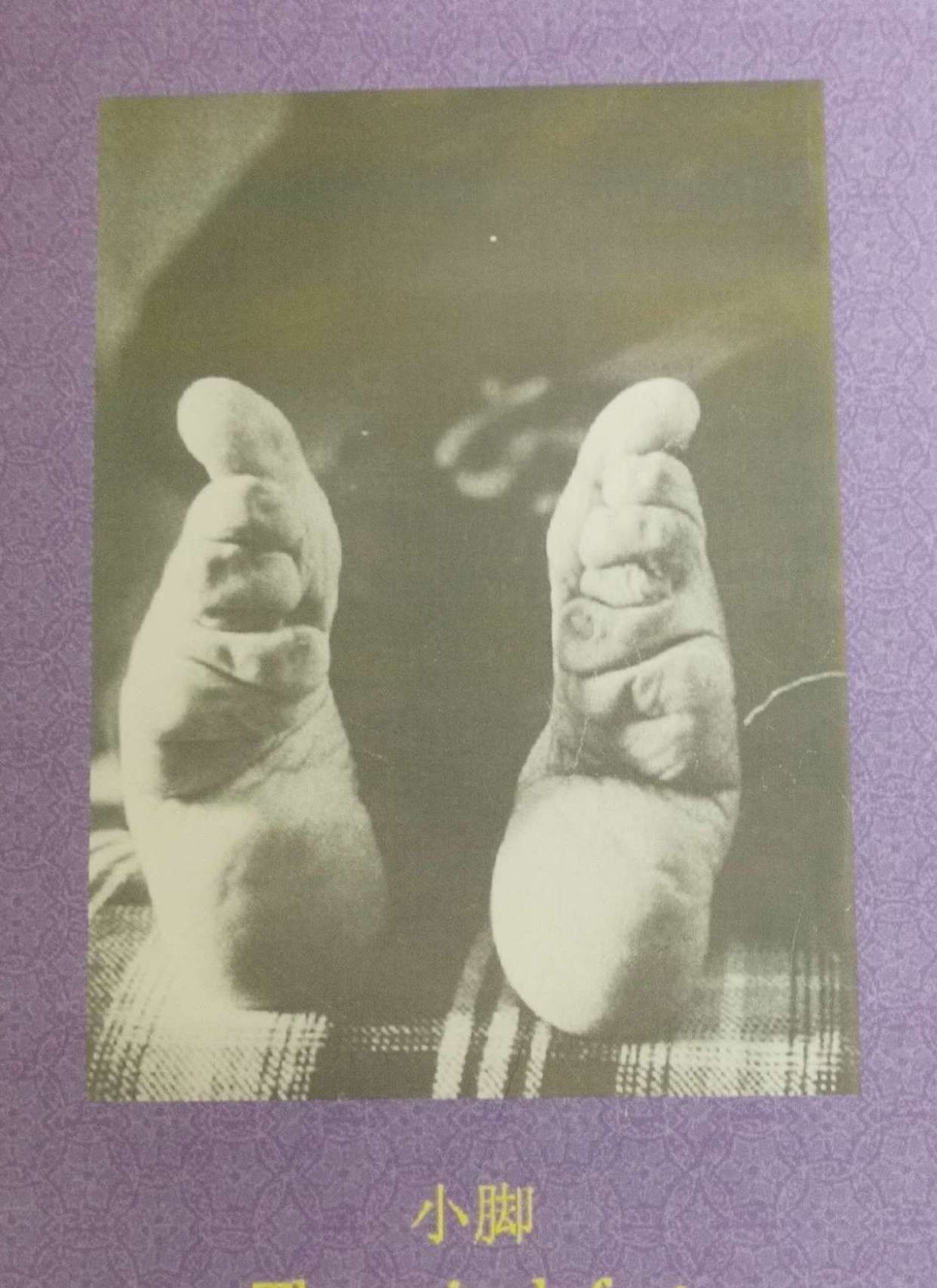 《成都建川博物馆聚落》里有着明代到清末妇女被缠脚的血泪历史