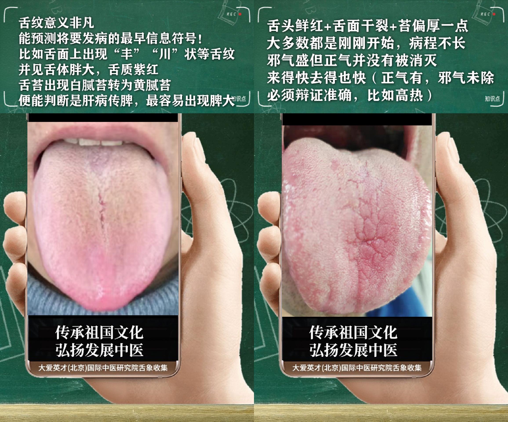 中医实例:面色黄暗,内分泌失调,鼻子不通,肝气郁滞|气郁|面色|内分泌