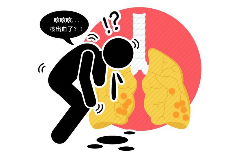 世界防治结核病日:能让文人追捧的肺结核,究竟是一种怎样的疾病