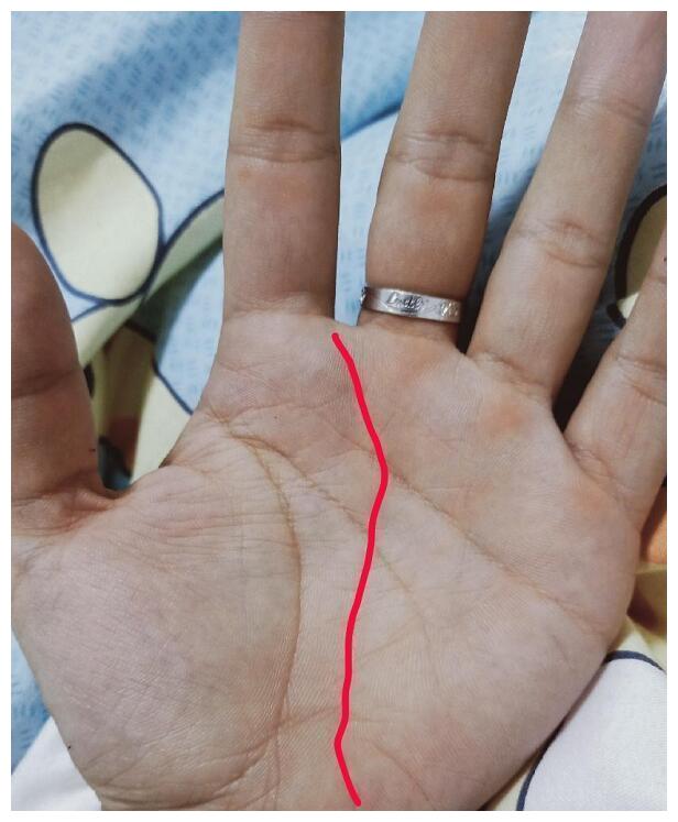 麻衣手相实例玉柱纹乾宫出名利双收天纹杂纹情感是非多