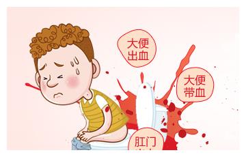 北京东大肛肠医院科普:排便出血伴有肛门疼痛到底是怎么回事?