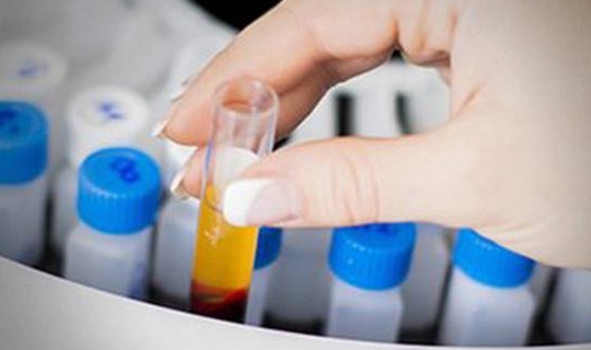 尿常规|血尿|肾病_新浪新闻