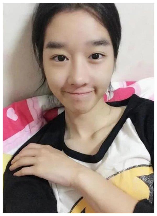 变美也没有错,还认为徐睿知绝对是成功的整容例子!