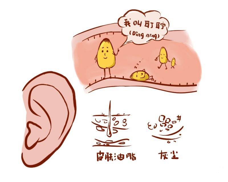 为何有人耳屎是湿的而有人却是干的提醒或与这件事有关