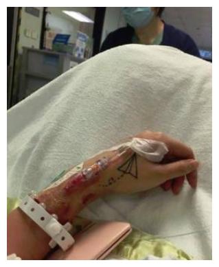 谢霆锋翻版妹妹伍淑怡,"露点裸照"被人兜售,割脉以死控诉