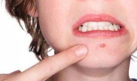 9岁小女孩脖子皮肤越来越黑，医生在病历上写下4个字，家人放心了休闲区蓝鸢梦想 - Www.slyday.coM