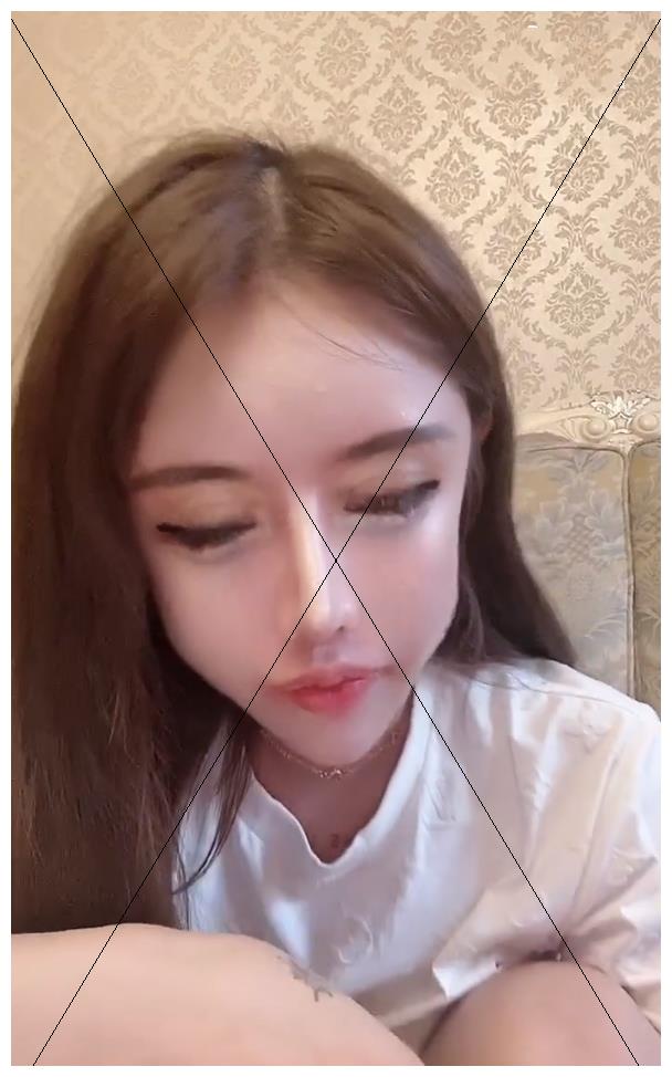 13岁女孩花百万疯狂整容,现状令人唏嘘