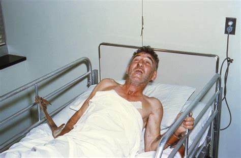 中年男子被狗咬伤,狂犬病发作离世,死前注射了疫苗,人还是没了休闲区蓝鸢梦想 - Www.slyday.coM 中年男子被狗咬伤,狂犬病发作离世,死前注射了疫苗,人还是没了休闲区蓝鸢梦想 - Www.slyday.coM