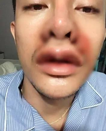 丑男整容之后变大帅哥,吸引众多女粉变网红,轻松走上人生巅峰!