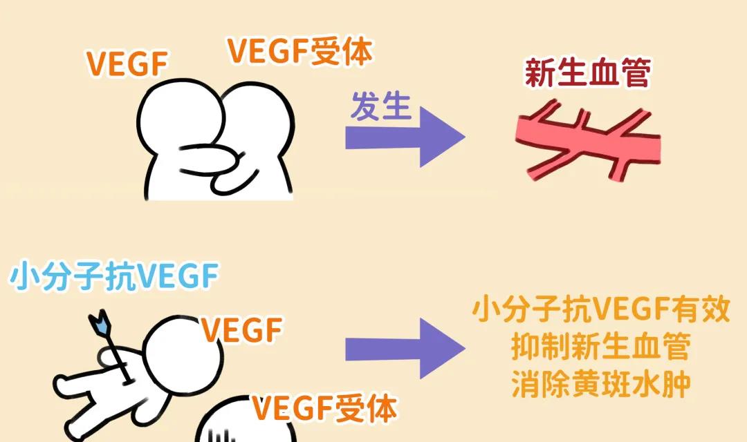 爱眼底揭秘小分子抗vegf药物如何在眼底病治疗中显神通