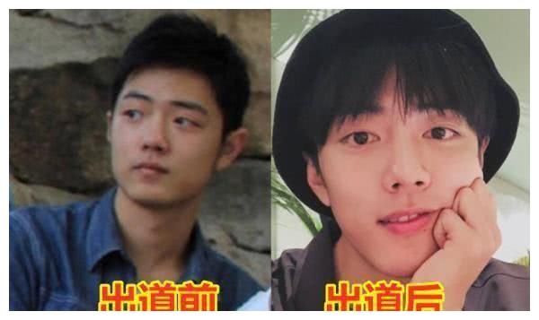 有一种整容叫明星出道前后肖战李现不算啥蔡徐坤变化大