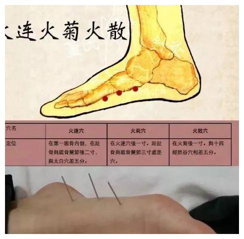 位置图】【心灵穴,三圣穴,火菊火連火散】临床上全部对侧取穴董氏针灸