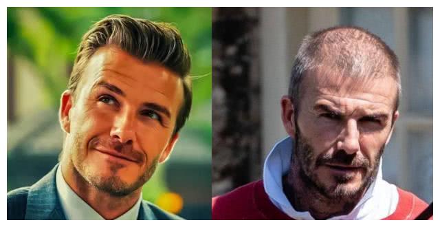 太秃然!再帅气也逃不掉秃头的10大男明星,第八位掩饰40多年