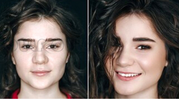 做超声刀前要注意什么,做超声刀后吃辣会怎样,别瞎整!休闲区蓝鸢梦想 - Www.slyday.coM 做超声刀前要注意什么,做超声刀后吃辣会怎样,别瞎整!休闲区蓝鸢梦想 - Www.slyday.coM