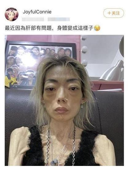 知名模特伍智恒切割肠胃变空壳人8年的豪门生活毁了她一生