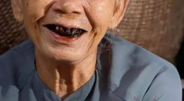 成瘾,致癌,污染口腔.槟榔提神醒脑的广告,已经是烂大街.