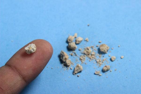 钙是人体内尿结石组成的主要成分,该成分在人体内的转化高峰一般为