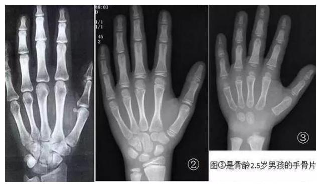 田亮女儿爆发式长大12岁身高接近170初恋脸消失变女版田亮